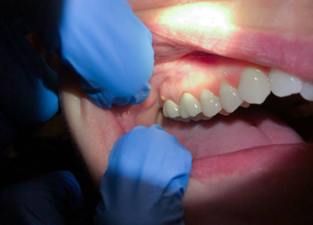 Best Pediatric Emergency Dentist in Mcgaheysville, VA